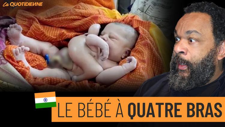 Épisode 507 : Le bébé à quatre bras