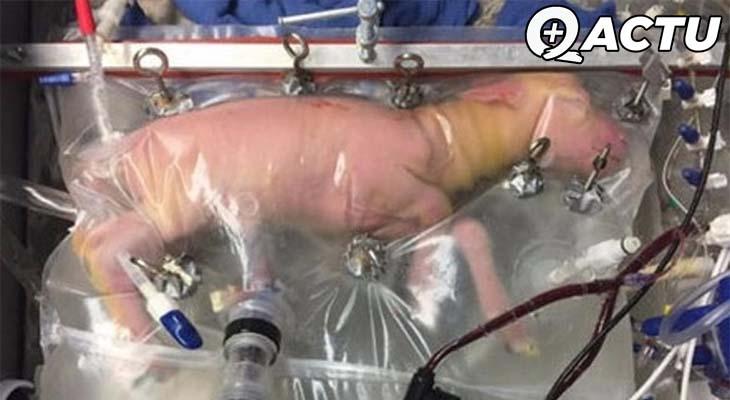Des utérus artificiels ?